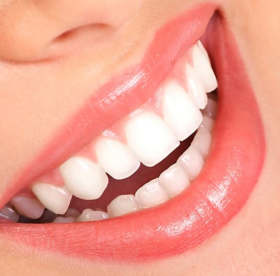 Lựa chọn phương pháp tẩy trắng răng hiệu quả