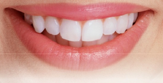Có phương pháp nào tẩy trắng răng vĩnh viễn?