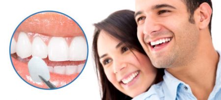 Bọc răng sứ veneer ở đâu tốt tại tphcm?